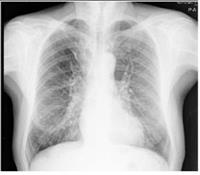 Hasta Röntgen Sonuçları